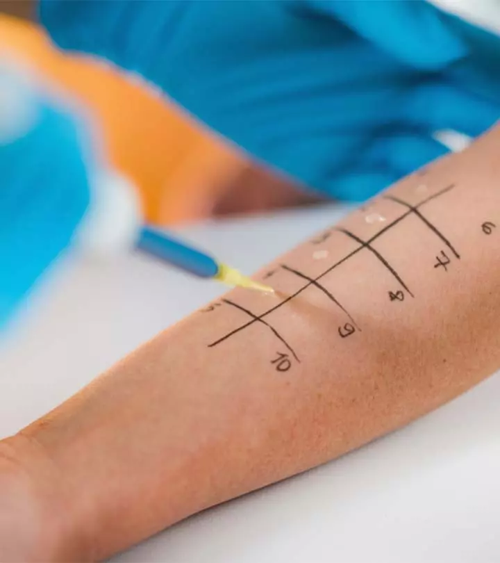 Skin Allergy Test: 4 Essential Types Explained