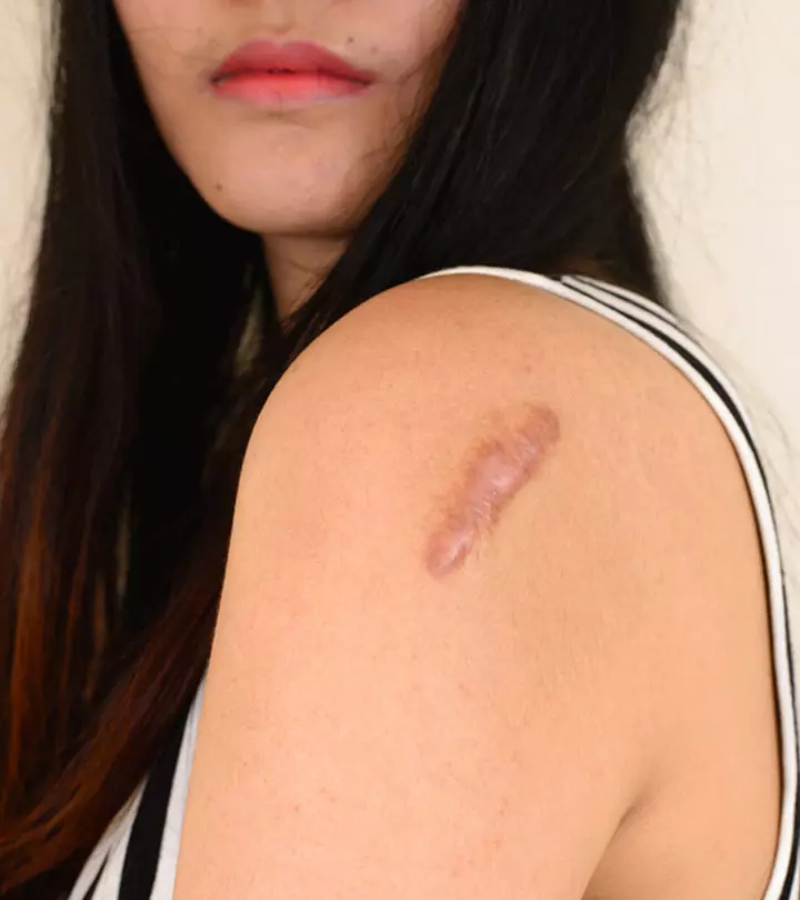 Skin Lesions: 11 Types, Causes, Symptoms, & Treatments